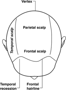 Hair loss assessment map